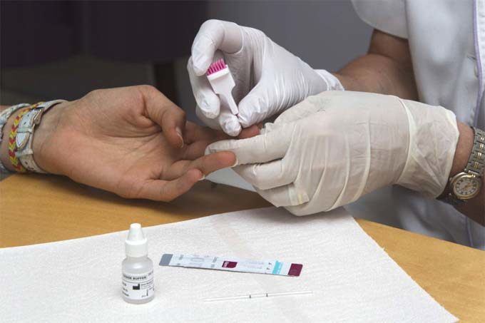 Lee más sobre el artículo Manifiesto 1D – 40 años de pandemia VIH-Sida